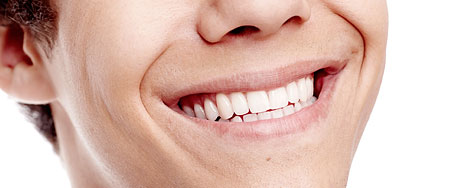 Versiegelung der Zähne beim Tragen einer Zahnspange